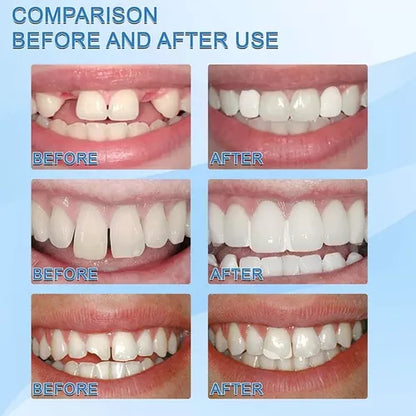 Resina Moldeable Dientes 3D