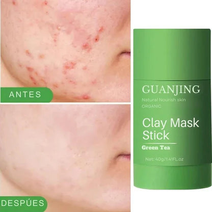 Mascarilla Anti Acné - Te Verde