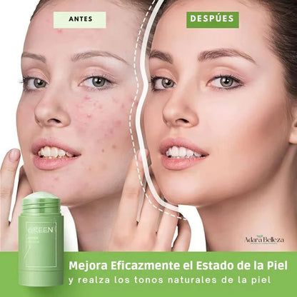 Mascarilla Anti Acné - Te Verde