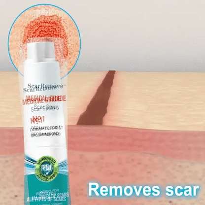 Spray - Elimina Cualquier Cicatriz En 3 Semanas