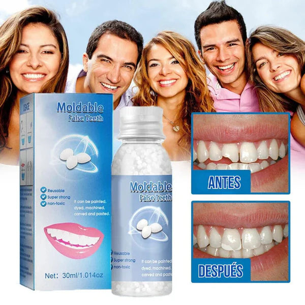 Resina Moldeable Dientes 3D